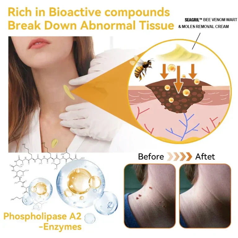 HOUKEA™Bee Venom Cream (Original)