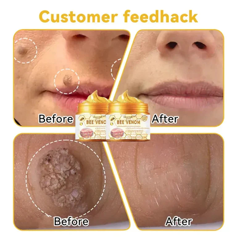 HOUKEA™Bee Venom Cream (Original)